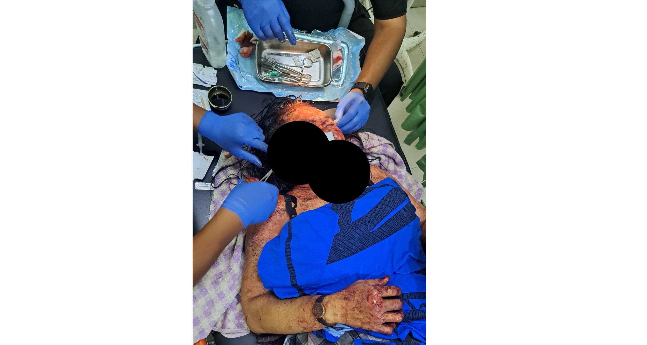 Seorang ibu rumah tangga saat menjalani perawatan serius usai menjadi korban perampokan, Sampit, Jumat (20/2/2026) dini hari