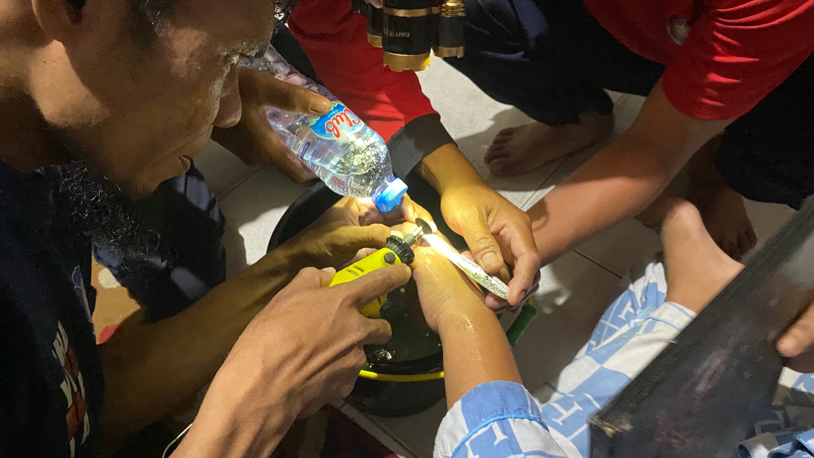 Upaya pelepasan cincin tersangkut dari tangan salah satu warga di Kuala Pembuang, baru-baru tadi.