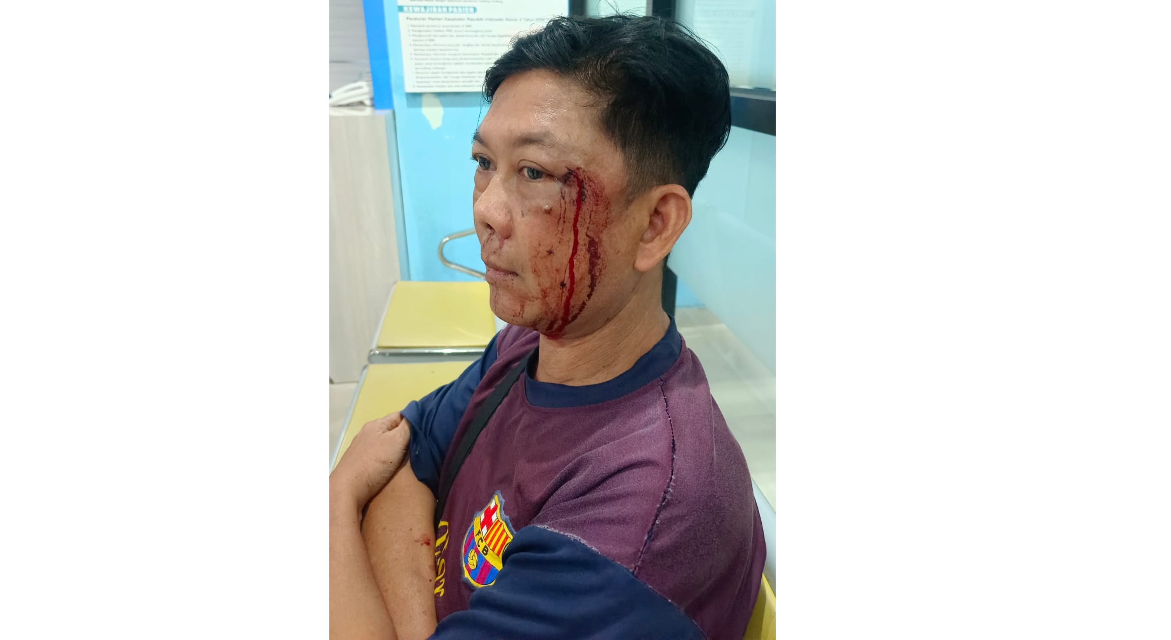 Korban penganiayaan, Ardiansyah saat akan menjalani visum di Rumah Sakit Umum Daerah Sultan Imanuddin Pangkalan Bun, Sabtu (7/3)