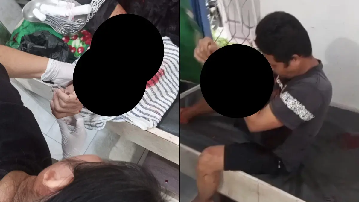 LUKA BACOK: Korban saat mendapat penanganan petugas kesehatan usai dibacok preman pasar di Desa Hampalit, Katingan. (warga/radar sampit)