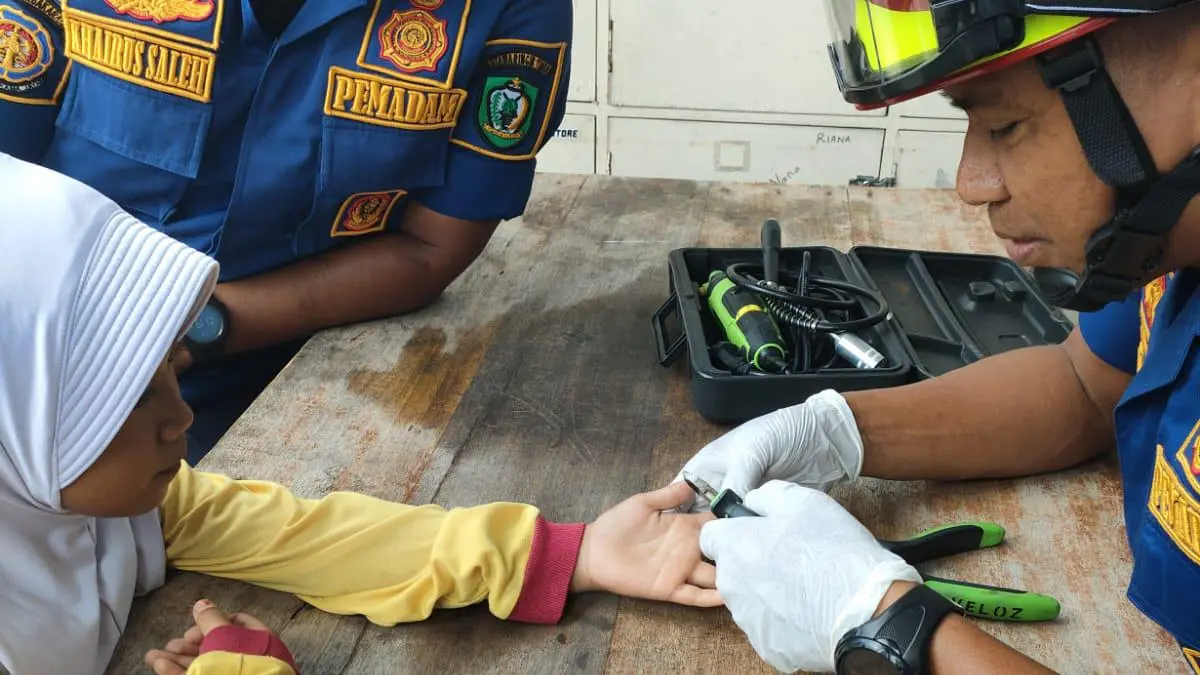 Kondisi jari seorang anak yang membengkak setelah terjepit pintu, sementara cincin masih melingkar di jari hingga terpaksa dipotong oleh petugas Disdamkarmat Kotim. (Disdamkarmat Kotim/Radar Sampit)&nbsp;