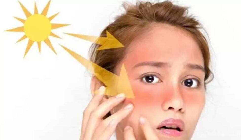 Ilustrasi kulit terpapar sinar matahari (Dok. Moms Money Images)