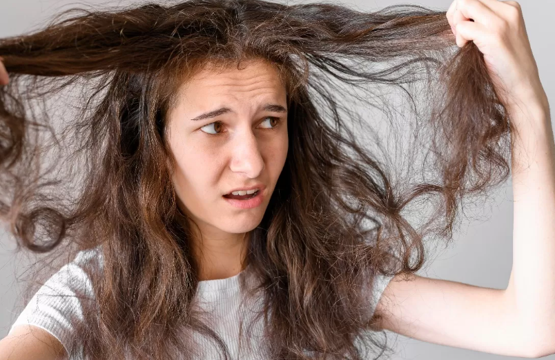Perawatan rambut kering dan rusak. (freepik)