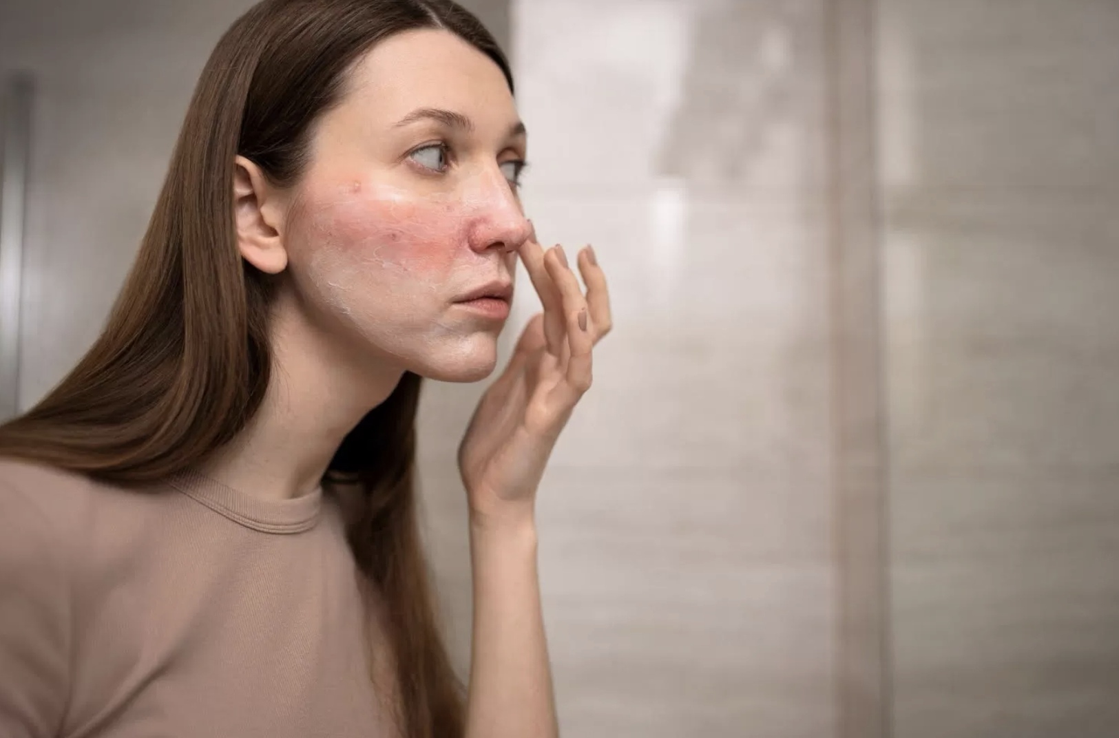 Ilustrasi mengatasi skin barrier rusak (Freepik)