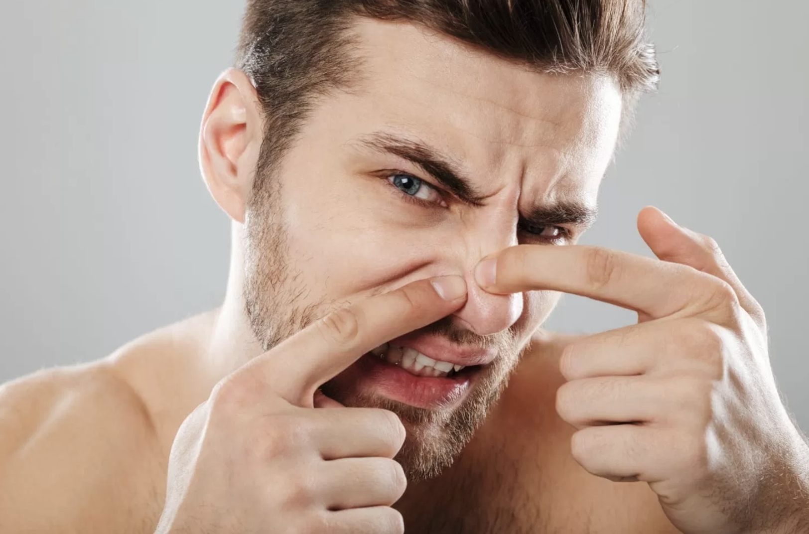 Ilustrasi jerawat di hidung. (Freepik)