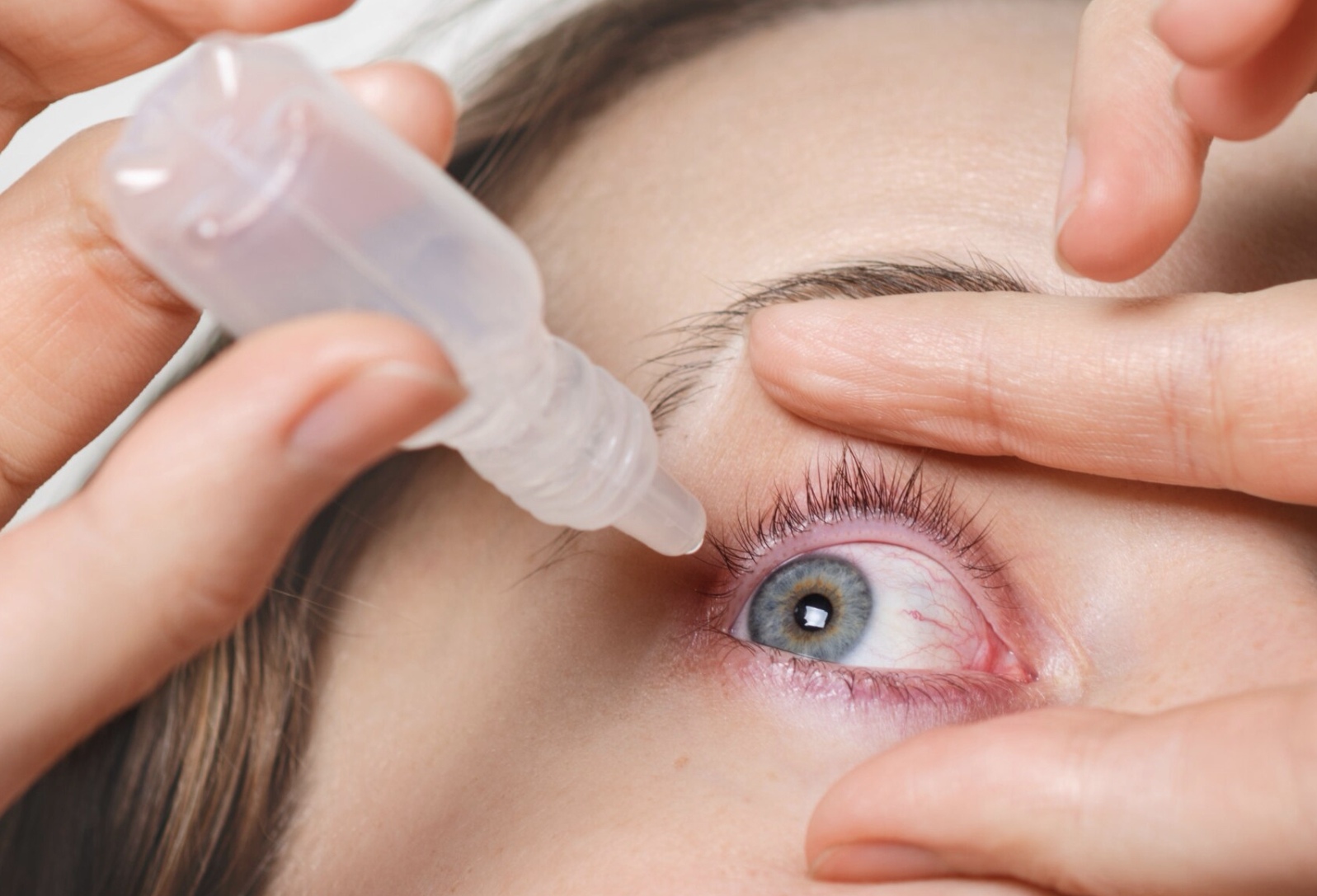 Kamu perlu tahu cara mengatasi mata merah untuk meredakan ketidaknyamanan pada mata. (Freepik)