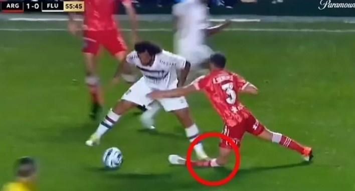 Kaki bek asal argentina Luciano Sanchez  patah diinjak mantan pemain Real Madrid Marcelo.  (Daily Mail)
