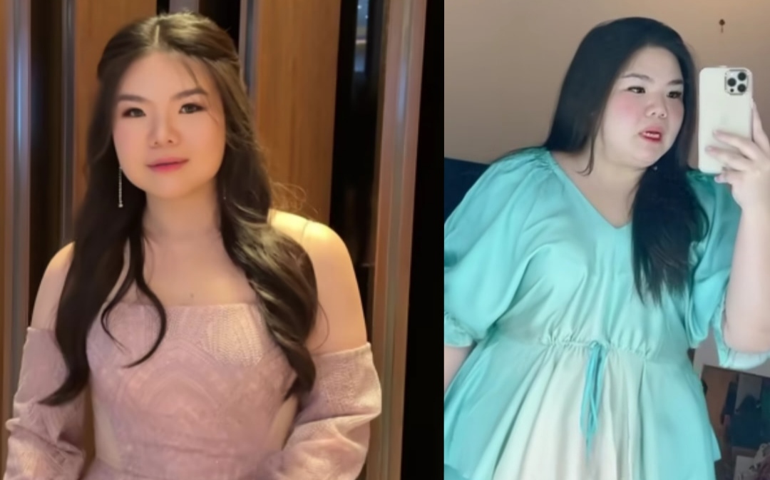 Shani Amelia sebelum dan sesudah menjalankan diet.
