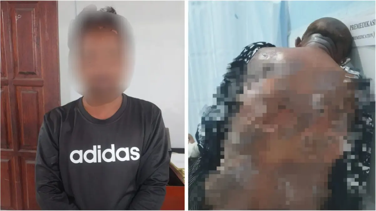 Pelaku JM sudah diamankan Polres Bitung, foto lain korban AT mendapatkan perawatan medis di rumah sakit.(Dok Istimewa)