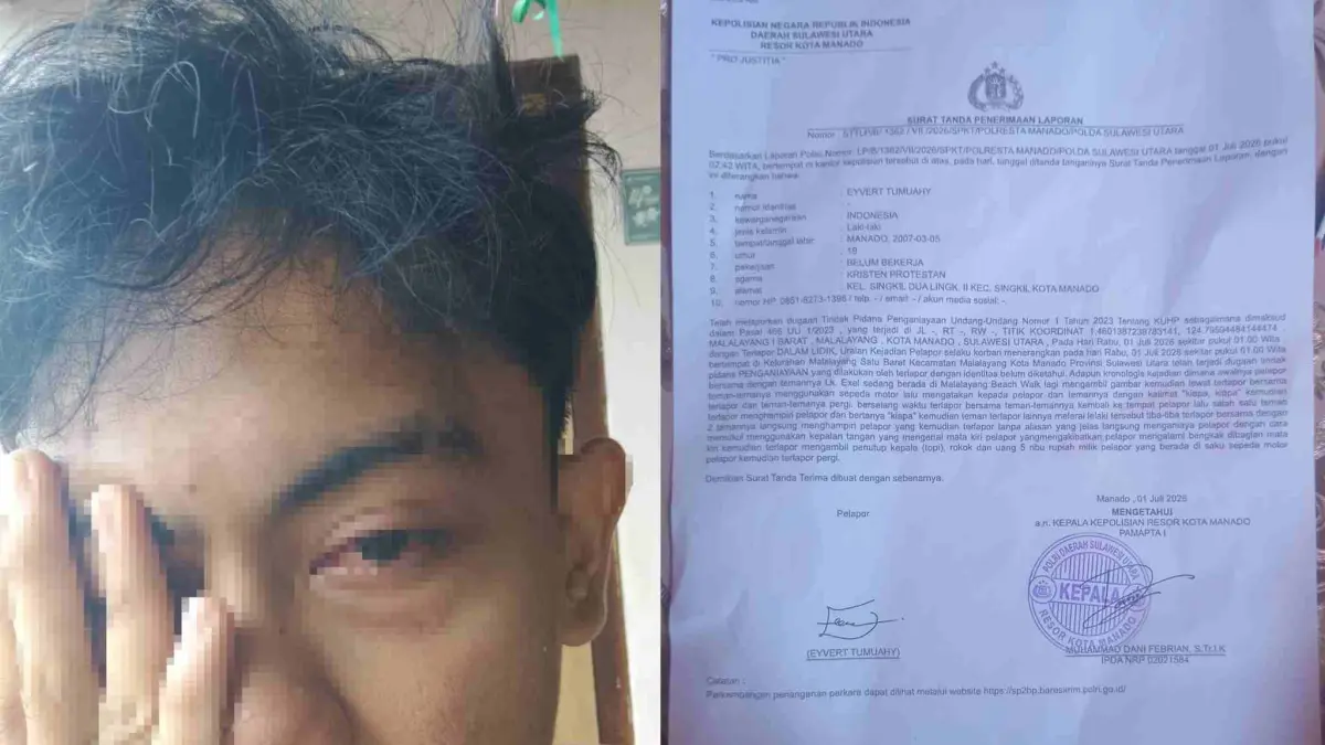 Eyvert Tumuahi (19) korban penganiayaan orang tak dikenal di area Malalayang Beach Walk, Rabu (1/7/26).