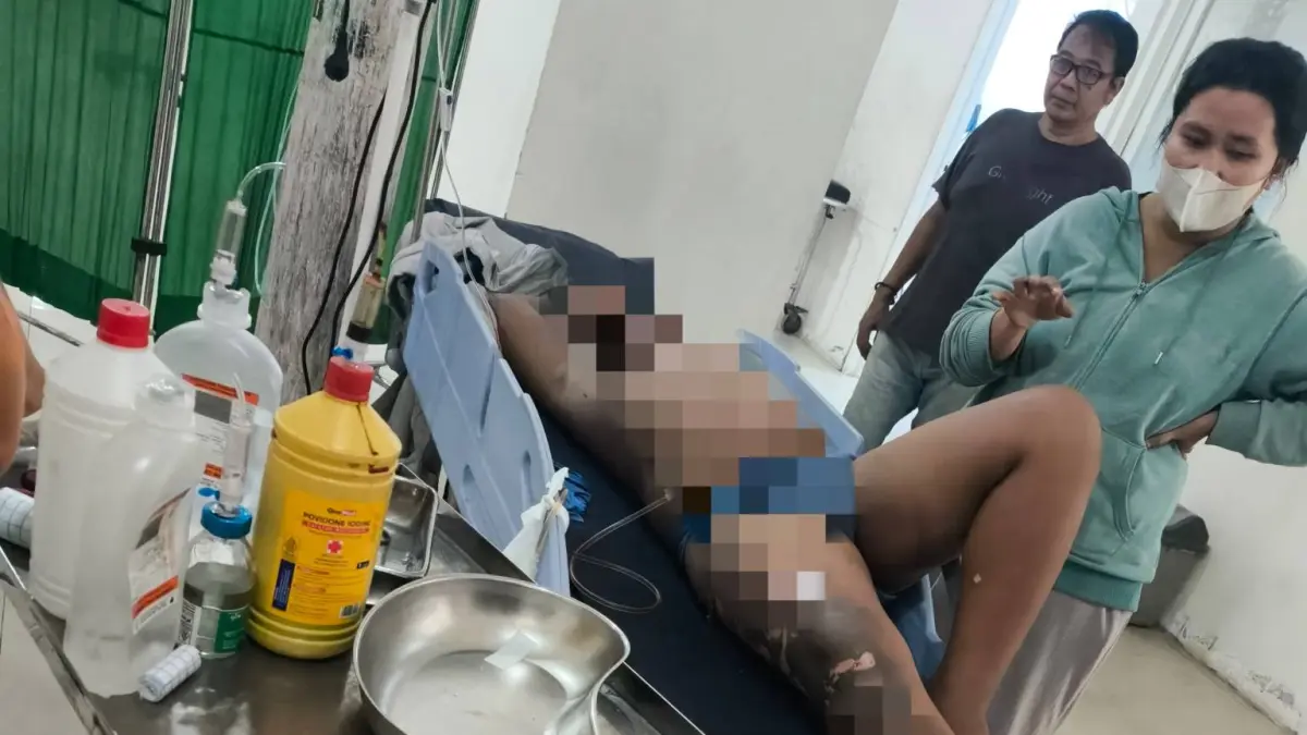 Memprihatinkan; Korban saat mendapatkan perawatan medis. Foto : Ist