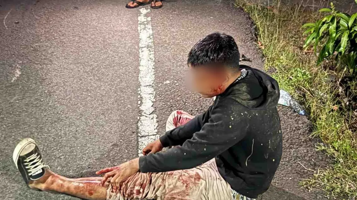 Korban SS (25) yang mengalami kecelakaan tunggal.