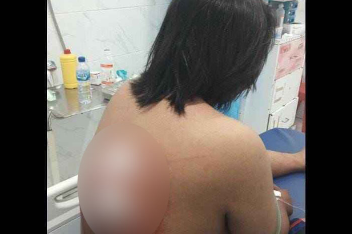 Kondisi salah satu Mahasiswa Universitas Muhammadiyah Bogor Raya korban penyerangan gangster di kawasan Empang, Sabtu (11/5/2024) dini hari.