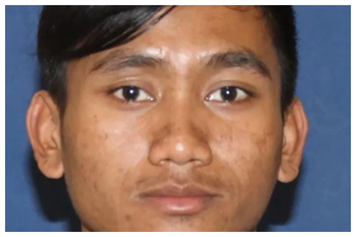Pegi Setiawan alias Perong, terduga pelaku utama pembunuhan terhadap Vina Cirebon akhirnya diringkus polisi.