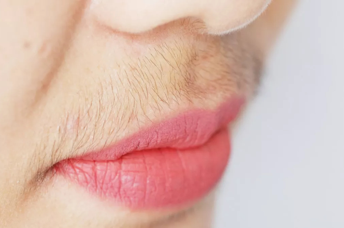 Ilustrasi kumis pada wanita