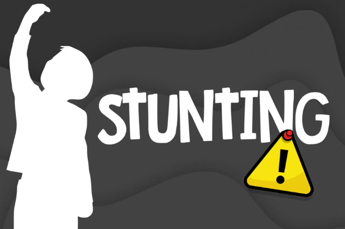 Ilustrasi kasus stunting di Cibungbulang Bogor