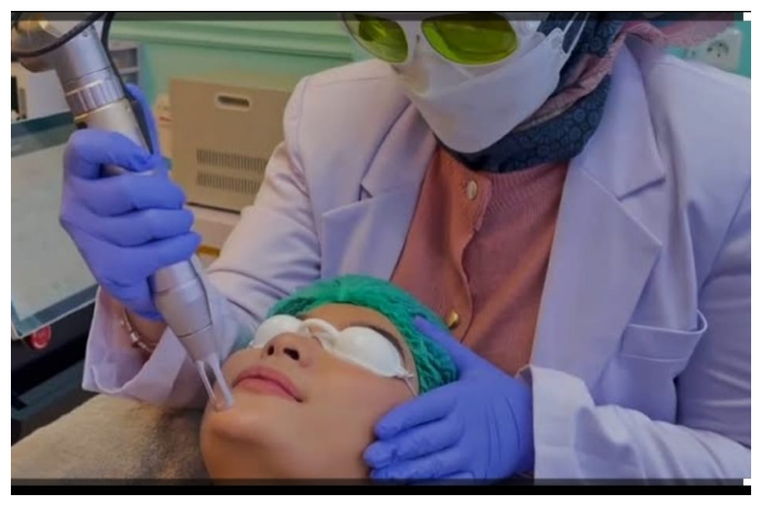 Pico Laser, dapat digunakan untuk berbagai masalah kulit, seperti keriput, bekas luka, dan pori-pori besar.