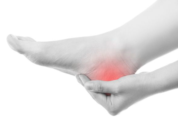 Ilustrasi sakit tumit atau plantar fasciitis