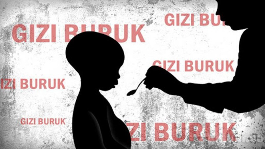 Ilustrasi gizi buruk