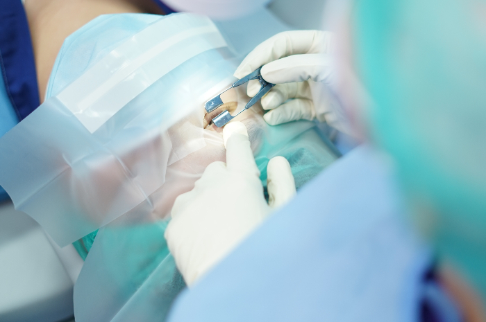 Layanan Laser Vision Correction (LVC) terbaru yang dilengkapi dengan teknologi ZEISS yang canggih SMILE Pro Hyperopic di Mayapada Eye Centre.&nbsp;