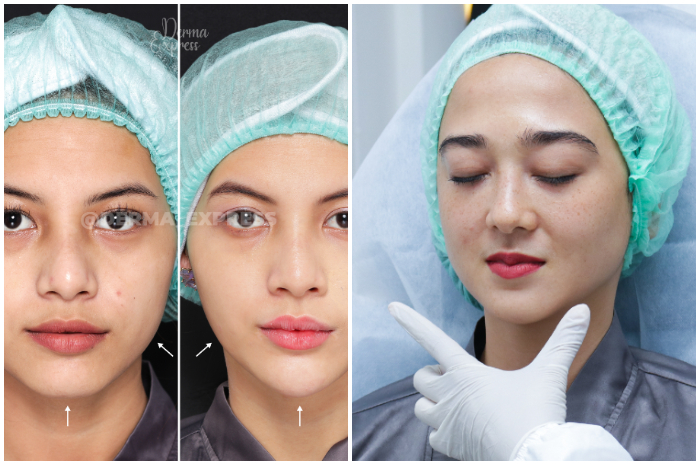 Derma Express, aesthetic clinic ternama hadir di Jalan Bangbarung Raya Bantarjati, Bogor Utara.