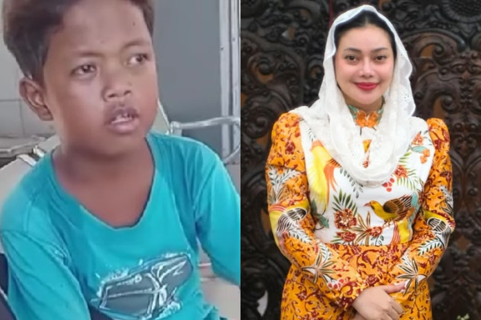 Belum sempat bertemu Gubernur Jawa Barat, Dedi Mulyadi kini Adnan Prasetyo&nbsp;jadi anak asuh&nbsp;Bupati Brebes, Paramitha Widya Kusuma.