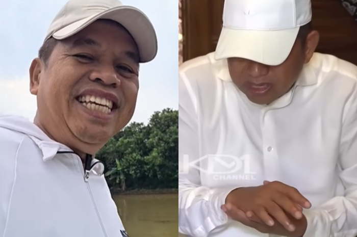 Gubernur Jawa Barat Dedi Mulyadi mengungkapkan kondisi tangannya yang bengkak.