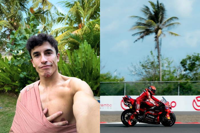 Marc Marquez alami retak tulang akibat kecelakaan dalam ajang MotoGP di Mandalika, Lombok.
