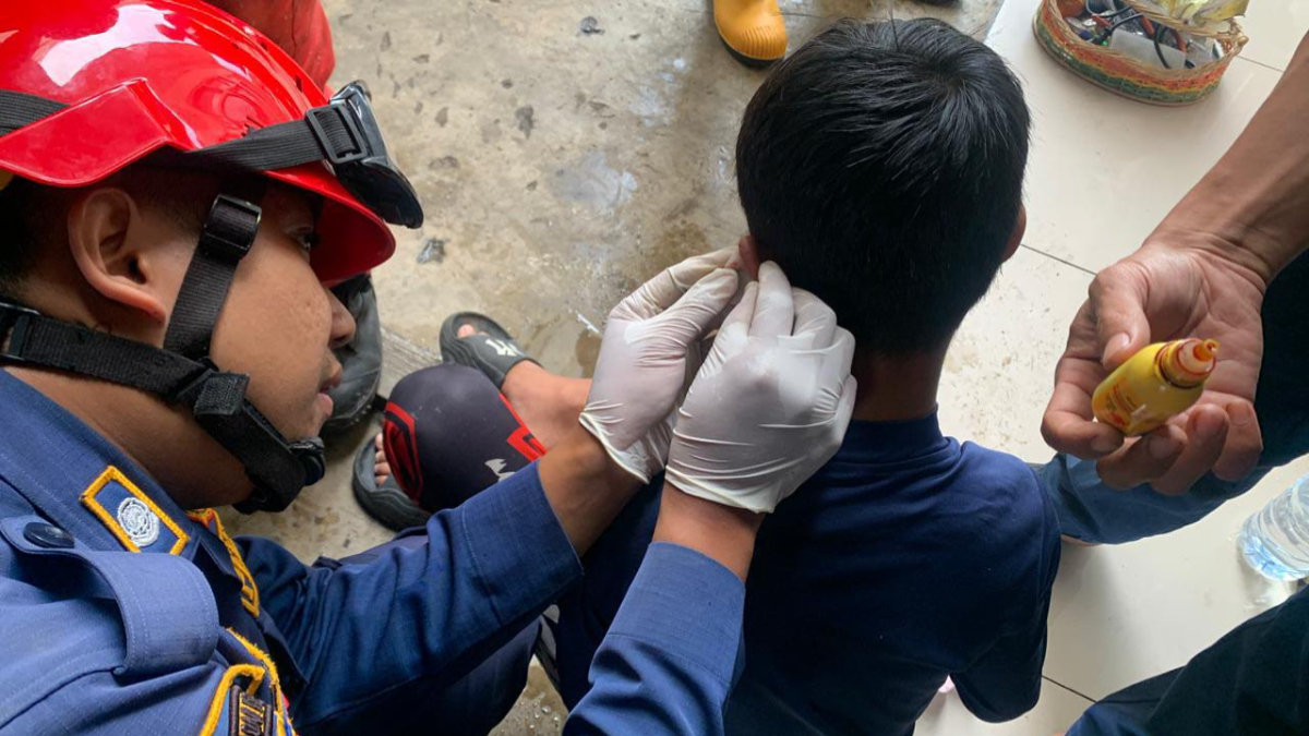 Petugas Damkar saat mengevakuasi kail pancing yang tersangkut di telinga bocah asal Cibinong, Kabupaten Bogor.