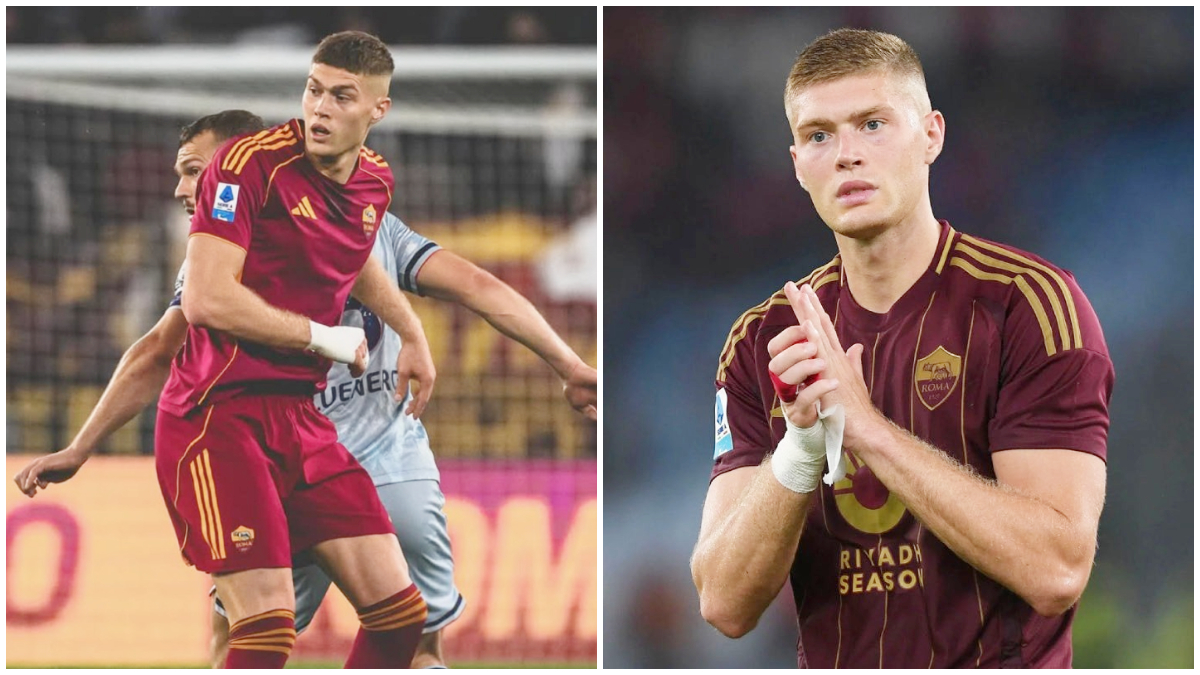 Artem Dovbyk saat AS Roma menghadapi Udinese sebelum mengalami cedera.