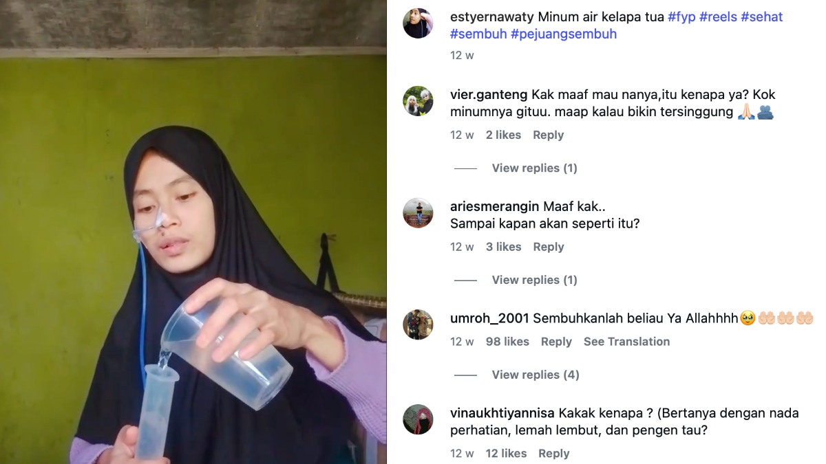 Estyernawaty, wanita asal Tasikmalaya yang viral akibat menderita penyakit langka.