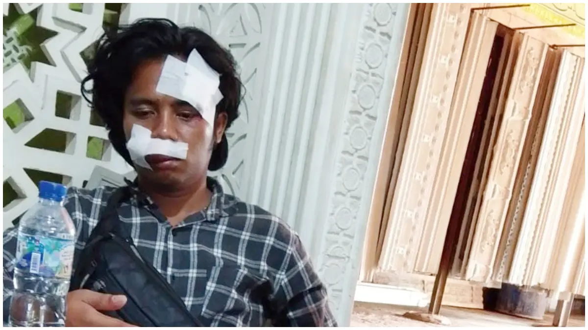 Pengendara sepeda motor jadi korban kecelakaan akibat aksi balap liar di Cibinong. (Foto : Dok Pribadi)