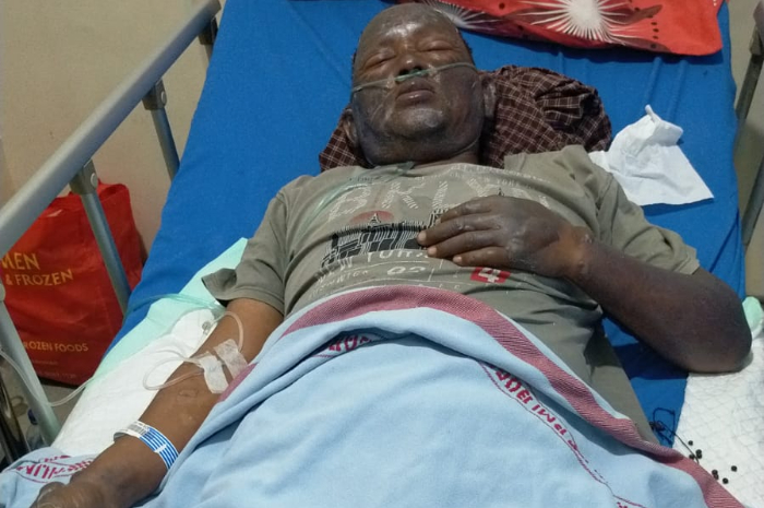 Petugas Kebersihan DLHK Kota Bogor Jadi Korban Ledakan Gas Elipiji 3 Kg