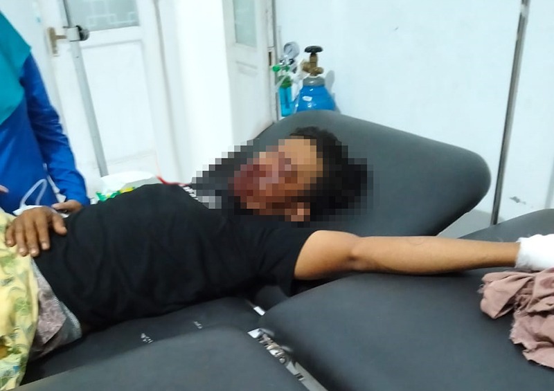 KORBAN : Inilah sosok korban bom ikan meledak di Touna.(FOTO: HERIYANTO LIMAHU/RADAR PALU).