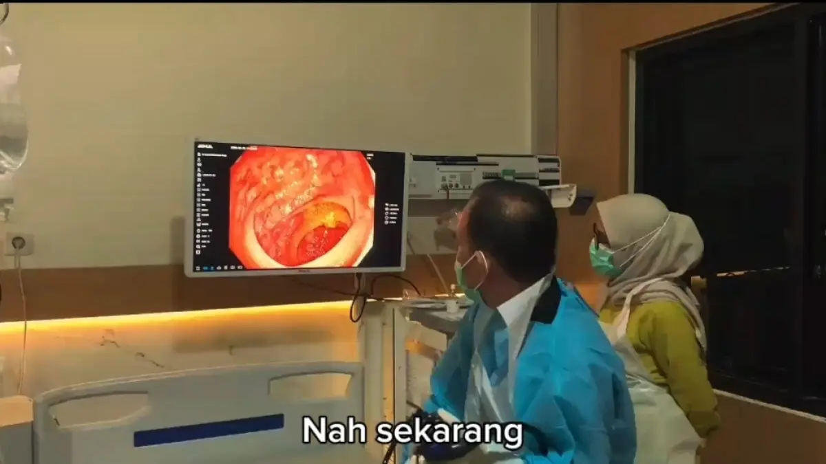 Dokter Spesialis Penyakit Dalam Subspesialis Gastroenterologi-Hepatologi dr. Muh. Nur Ikhsan Liwang memperkenalkan alat endoskopi baru di Rumkit Bhayangkara TK III Palu. Kehadiran fasilitas tersebut diharapkan mempercepat diagnosis sekaligus mengurangi antrean pasien di Sulawesi Tengah. FOTO: TANGKAPAN LAYAR VIDEO 