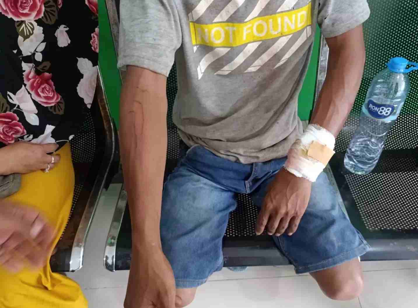 Seorang pria dengan perban di tangan sedang duduk di kursi roda. Ekspresi wajahnya terlihat kesakitan