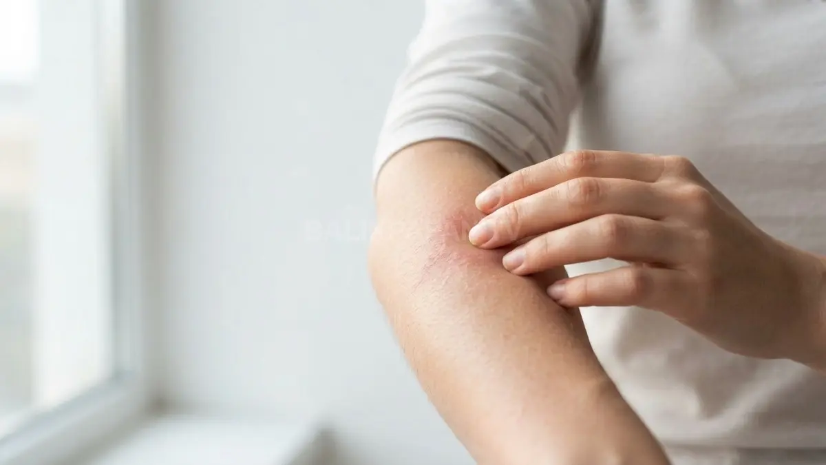 Perawatan tepat pada kulit sensitif dan kemerahan membantu merawat serta menjaga kesehatan skin barrier. (BTV/Ai)
