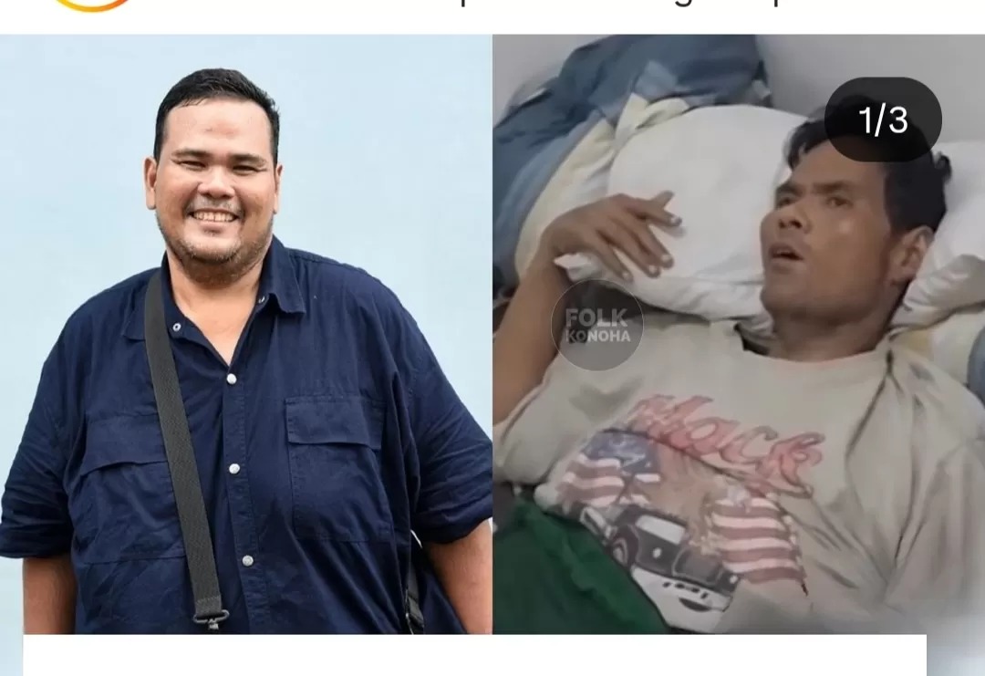 Kondisi Fahmi Bo saat ini.