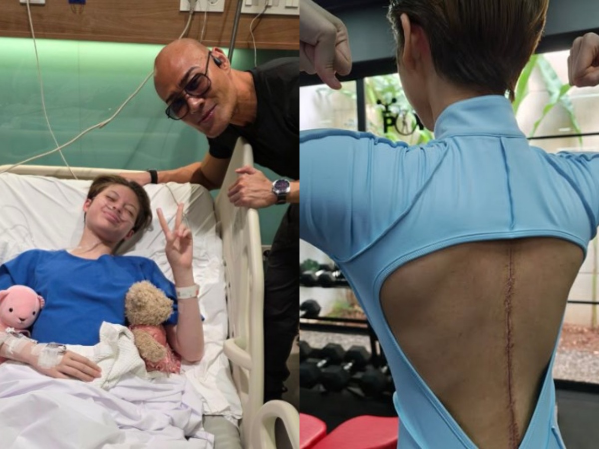Nada membagikan kondisi terkini pascaoperasi scoliosis.