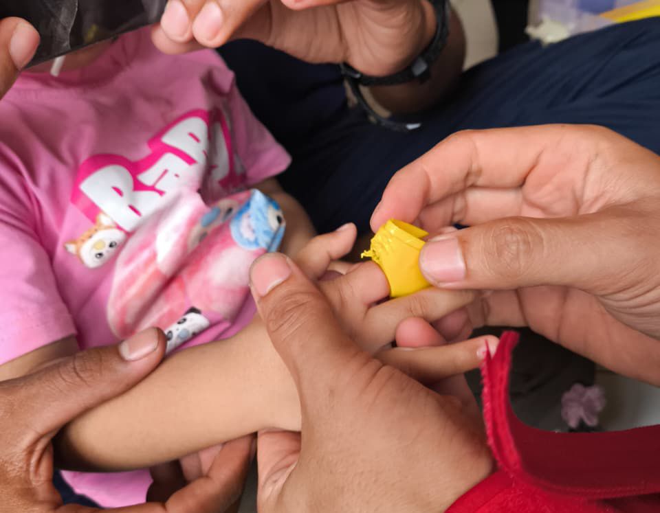 Petugas damkar beraksi melepas tutup mainan di jari balita. DAMKAR