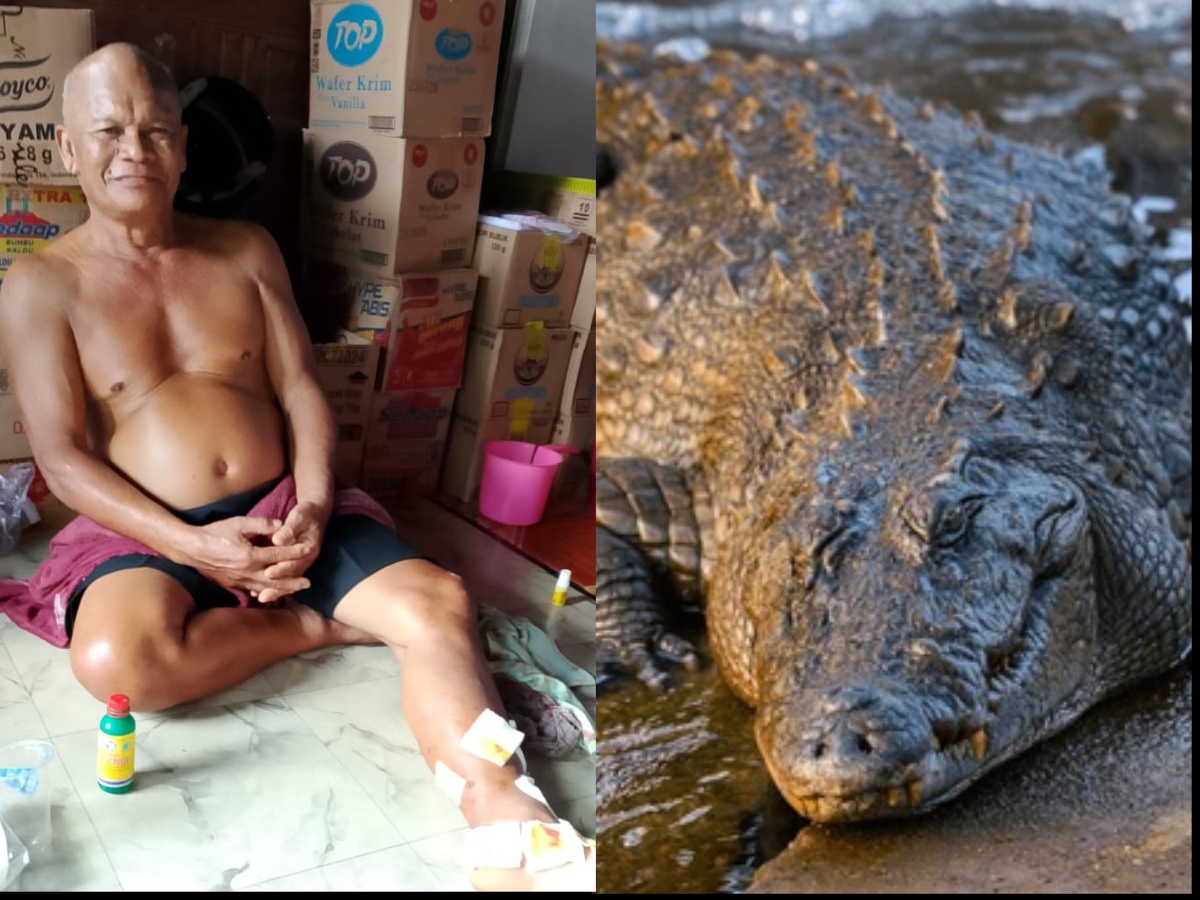 Kondisi korban serangan buaya.