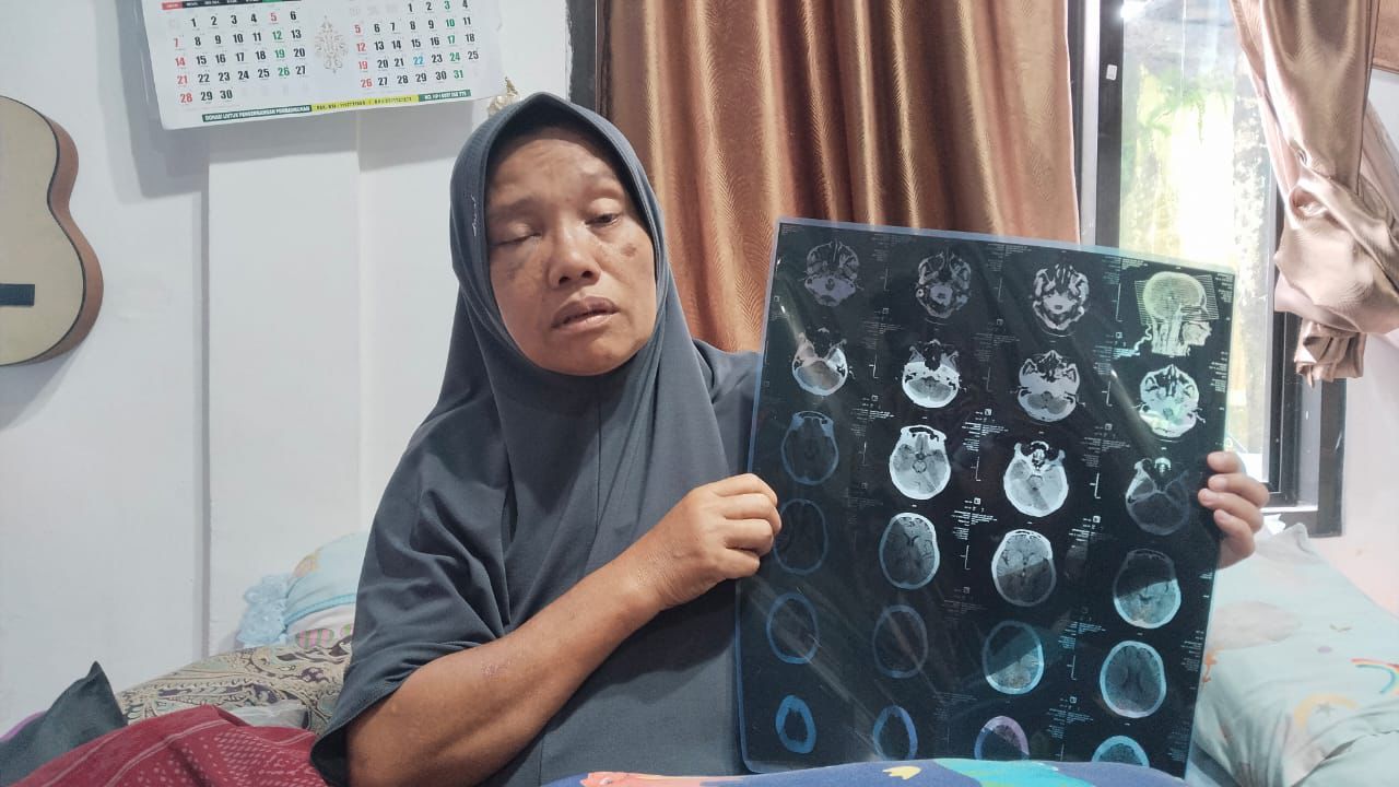 Korban penganiayaan.