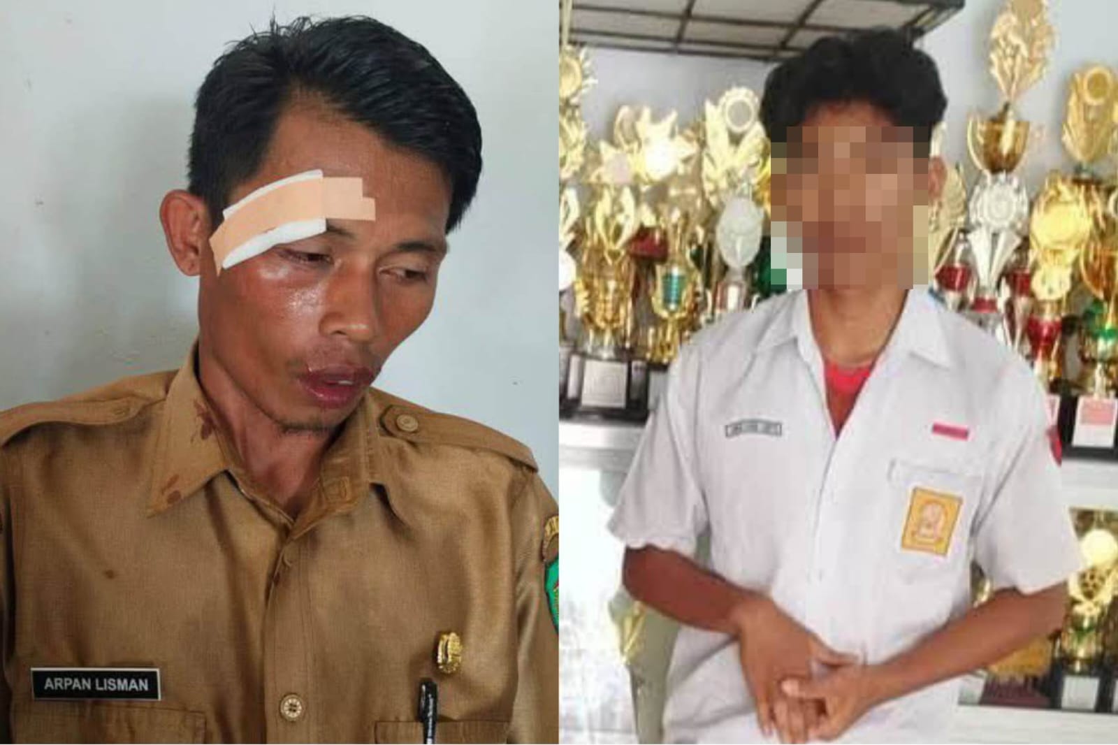 Kepala satpam SMP Negeri 1 Baebunta Selatan robek dipukul pelajar.SCREENSHOOT