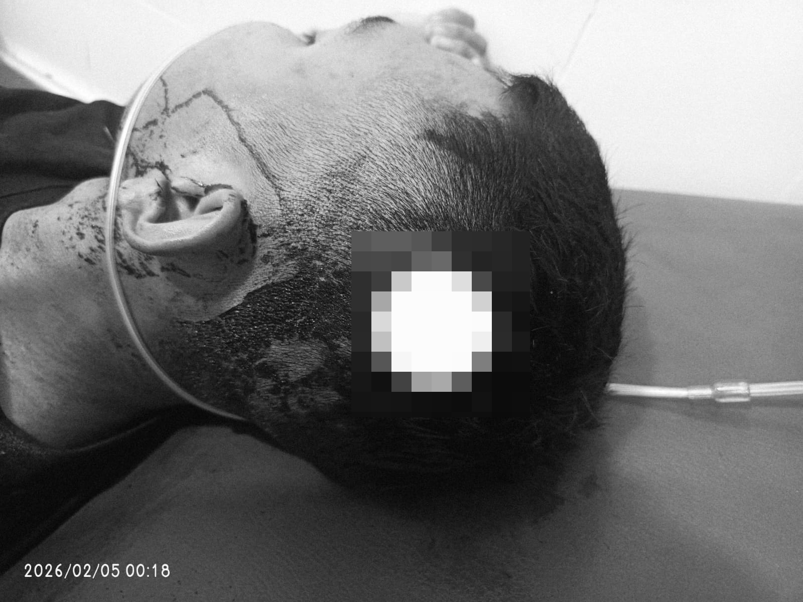 Kondisi korban penganiayaan.POLISI