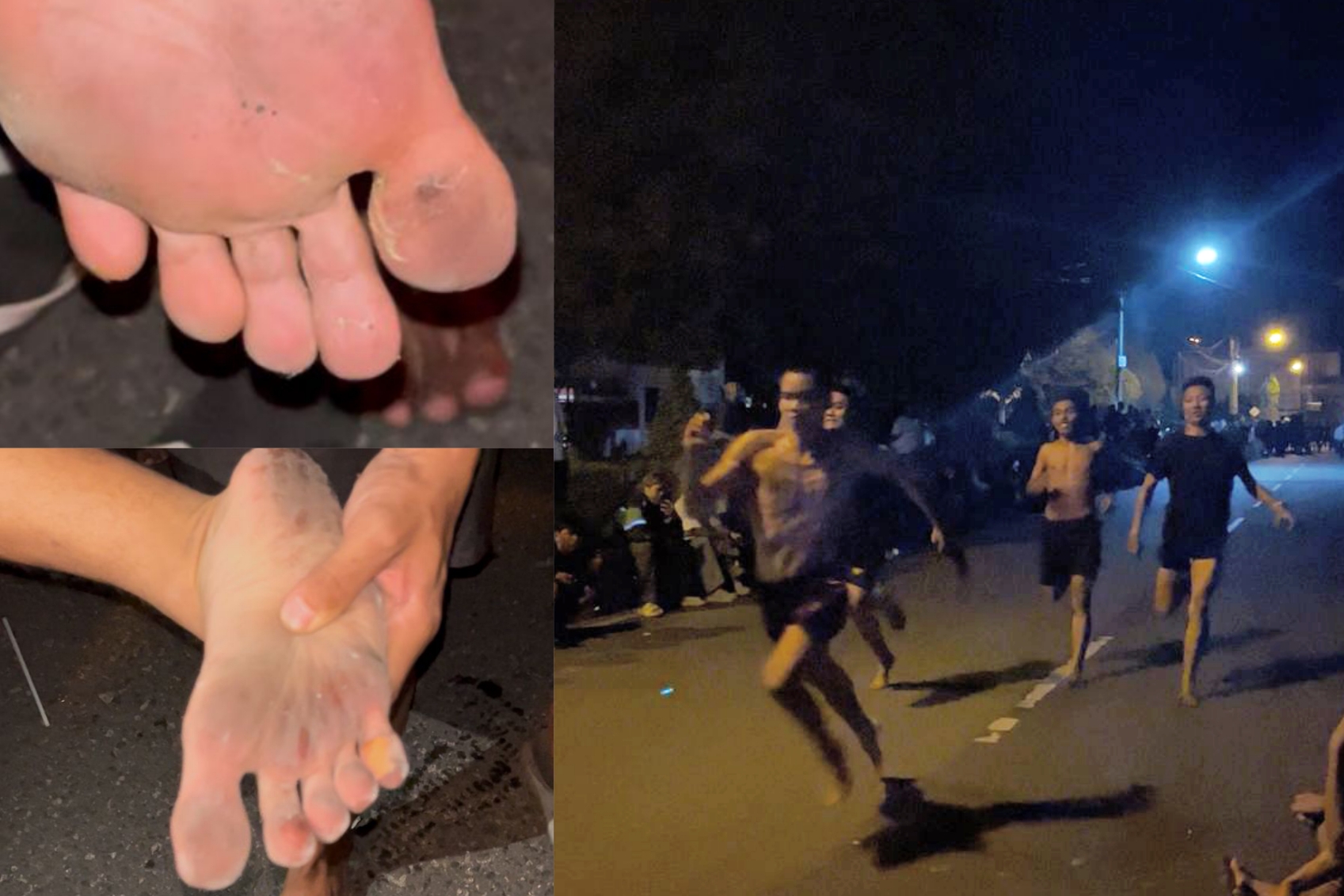 Kondisi kaki peserta lomba lari 100 meter tanpa alas kaki di kawasan Sanaman Mantikei, Sabtu (7/3/2026) malam. AYU/KALTENGPOS.JAWAPOS.COM