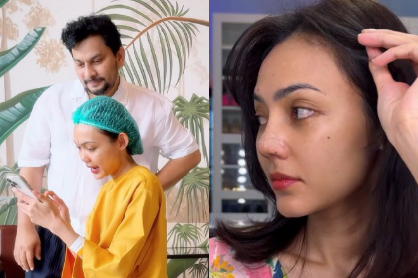 Rina Nose membagikan kondisi terkini usai menjalani operasi hidung. (Instagram/rinanose16)
