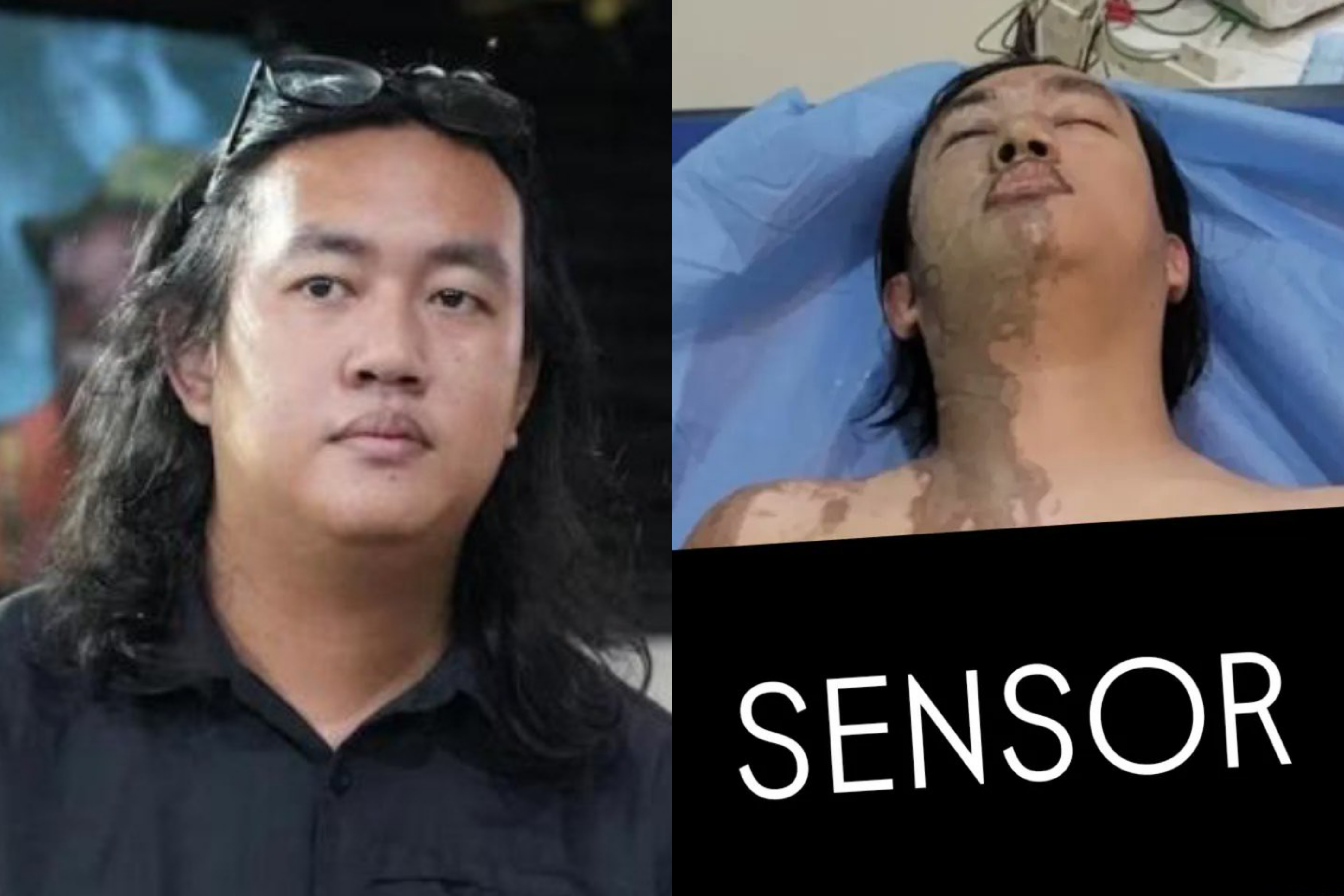 Mengintip sosok aktivis pembela HAM sekaligus Wakil Koordinator KontraS, Andrie Yunus yang menjadi korban penyiraman air keras oleh OTK. (Dok. Indonesia Corruption Watch)