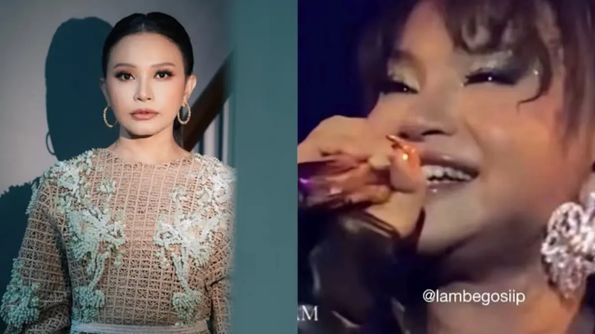 Rossa dituding gagal operasi plastik.