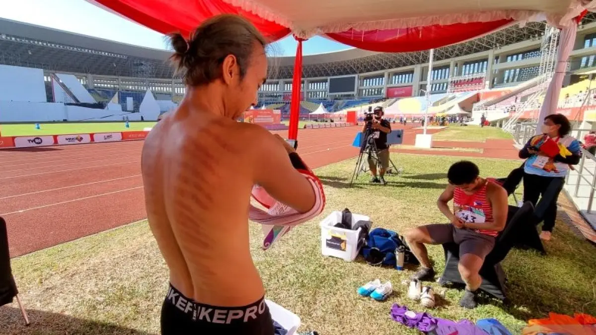 Atlet lompat jauh Indonesia Setiyo Budi Hartono menunjukkan punggungnya yang penuh dengan kerokan usai menyelesaikan lomba ASEAN Para Games 2022 di Stadion Manahan, Solo, Jumat (5/8/2022). FOTO ANTARA/BAYU KUNCAHYO
