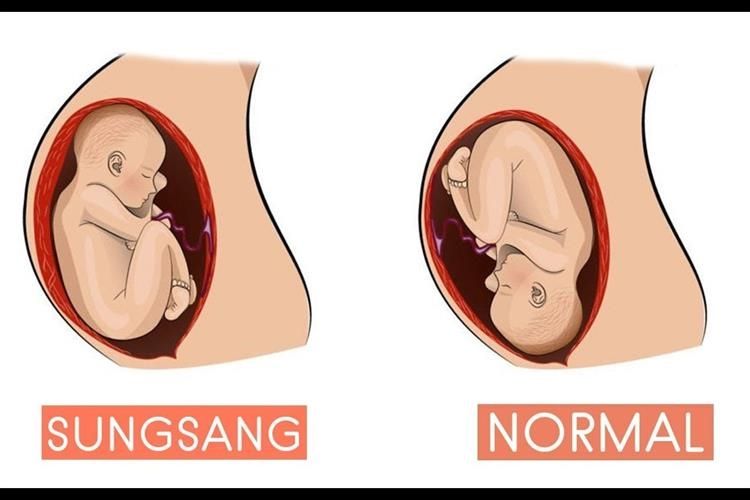 Sumber foto; health.grid.id